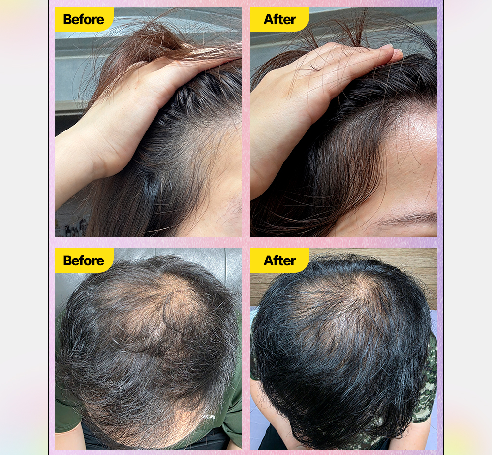 NEW_shampoo+ampoule_02.jpg