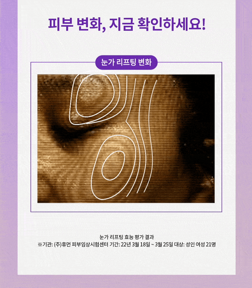 05번 뒤에뒤.gif
