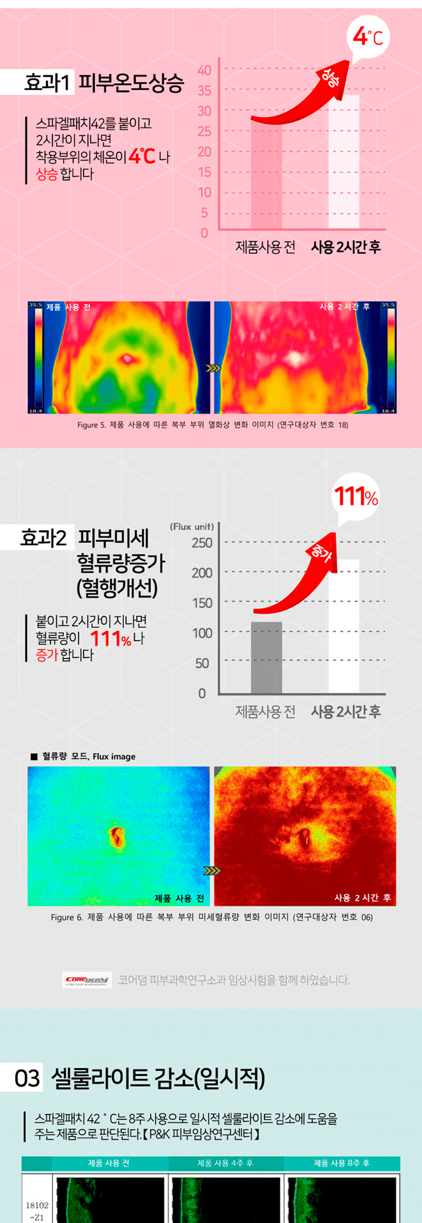 스파겔패치(미니)_04.jpg