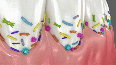 02 치아 세균GIF.gif