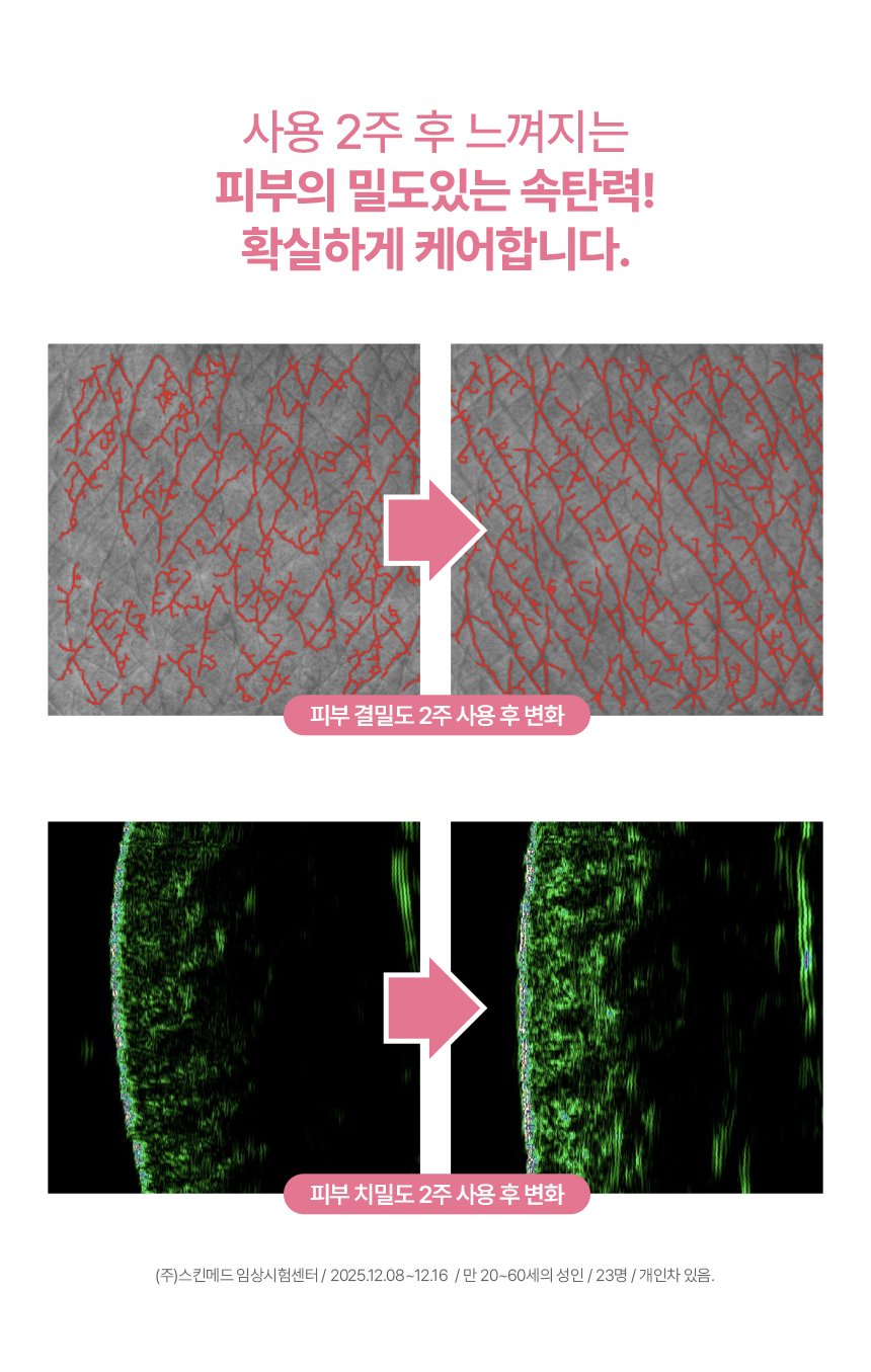 픽셀크림_상세페이지_260316_수정_11.jpg